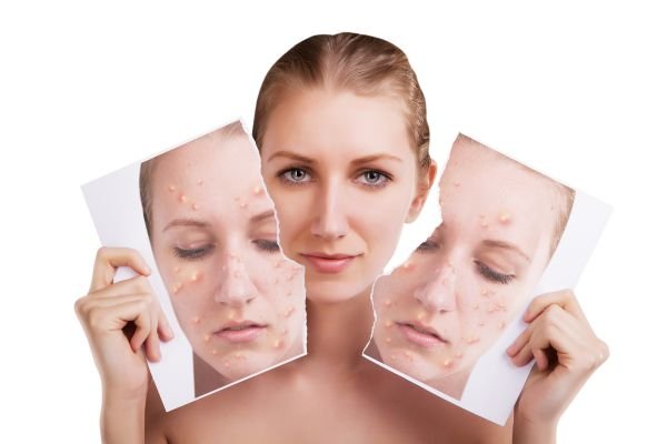 A closer look at significance of doing so for various types of skin.